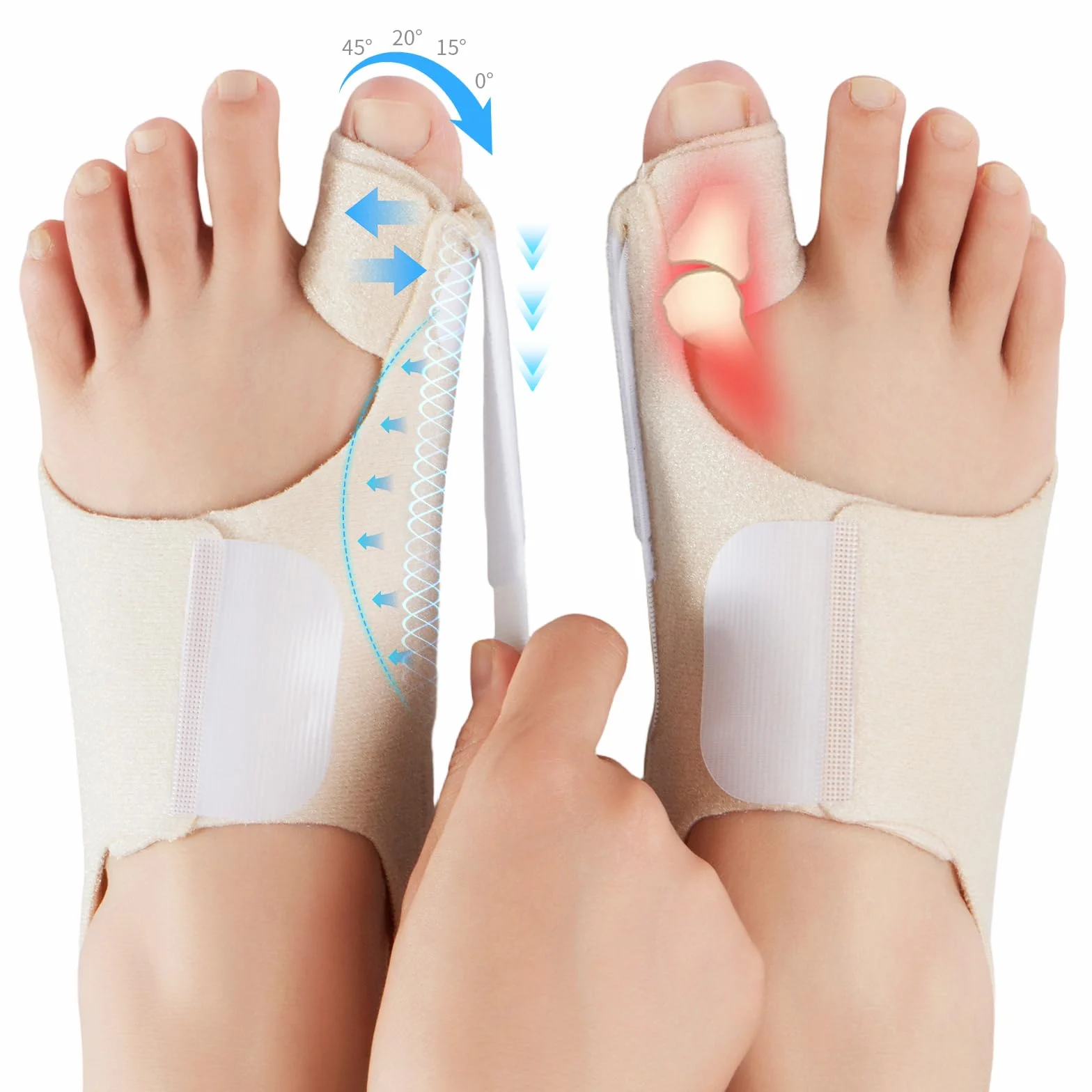Alluce Valgo Correttore per Donna e Uomo – Tutore Alluce Valgo Regolabile con Cuscinetto in Gel – Sollievo e Supporto per Alluce Valgo, 1 Paio