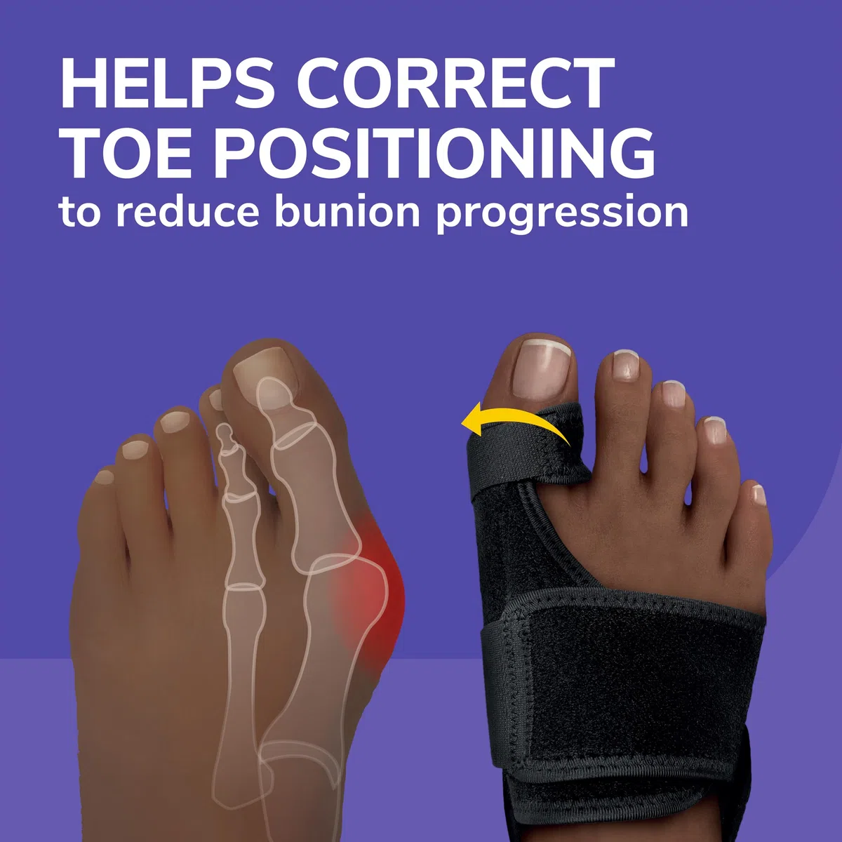 Dr. Scholl's Bunion Relief & Toe Corrector, 1 support set (1 left, 1 right)