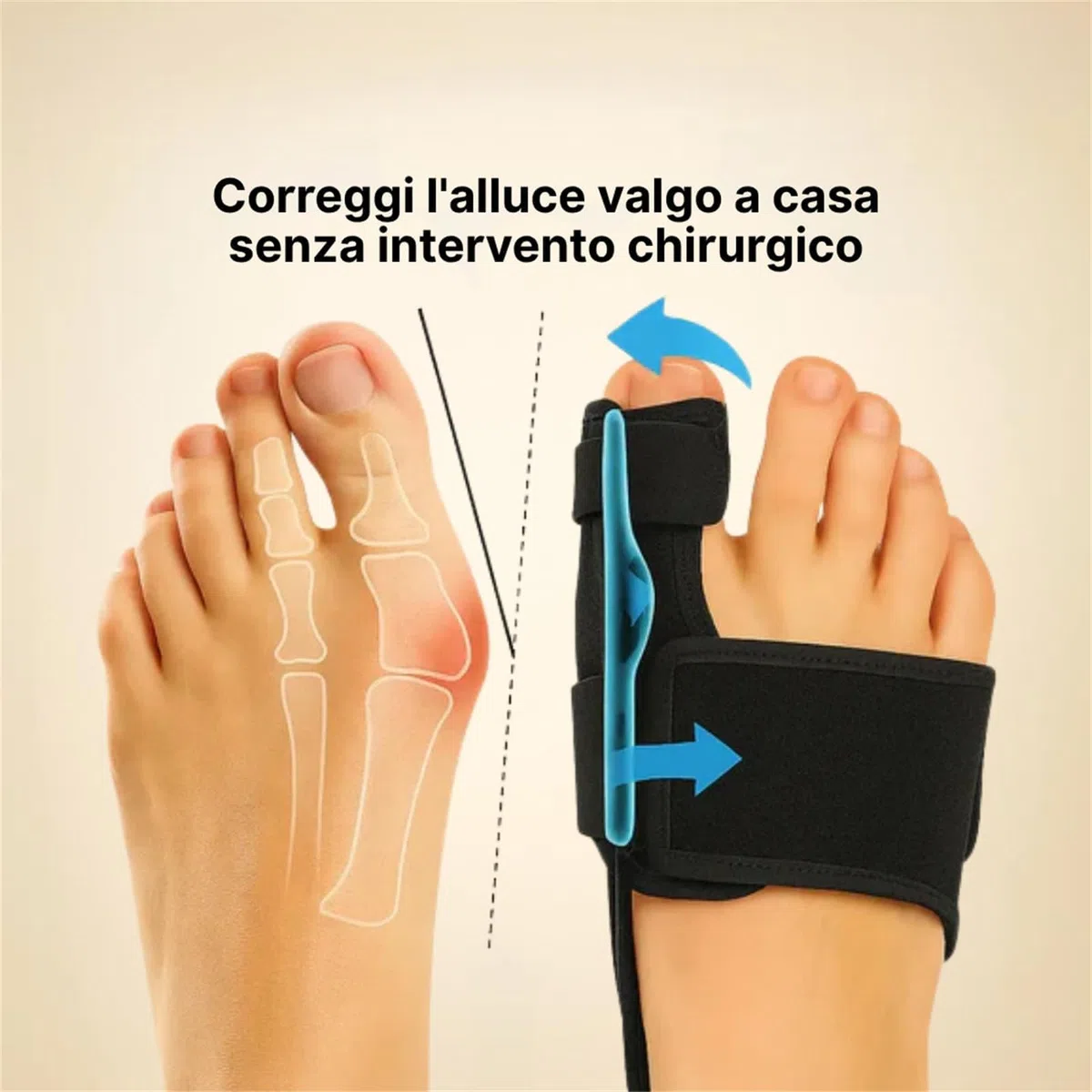 Generico Ortolex Valgux Tutore Correttore dell'Alluce Valgo (Hallux Valgus) 1 Paio di Stecche Correttive per Dita dei Piedi, Separatori Regolabili Unisex, Protezioni per Alluce e Dita