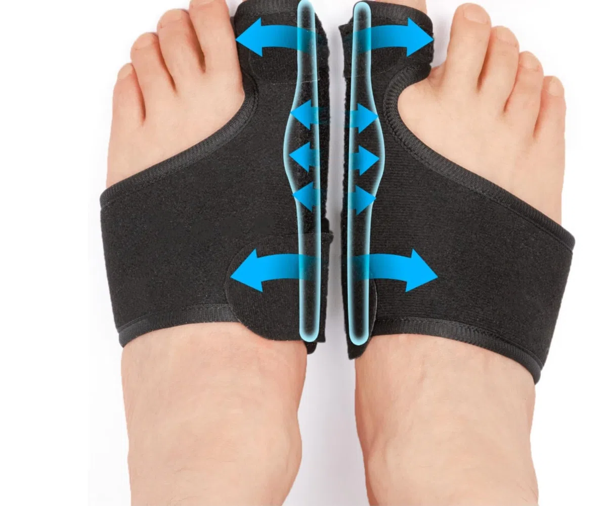 Ortolex Valgux Tutore | Correttore dell’alluce valgo (Hallux Valgus) 1 paio di stecche correttive per dita dei piedi, separatori regolabili unisex, protezioni per alluce e dita