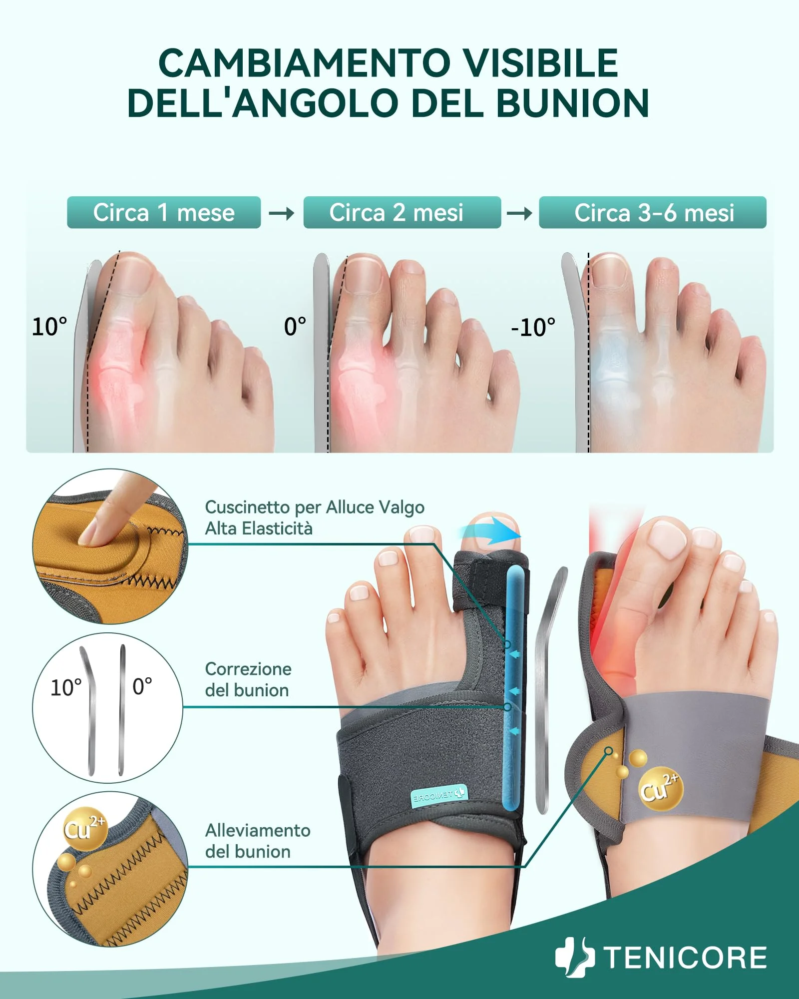 Aggiornamento Alluce Valgo Correttore con 2 Barre Angolari,Tutore Alluce Valgo con cuscinetto in silicone Sollievo dall'alluce Valgo Donna e Uomo 1Paio