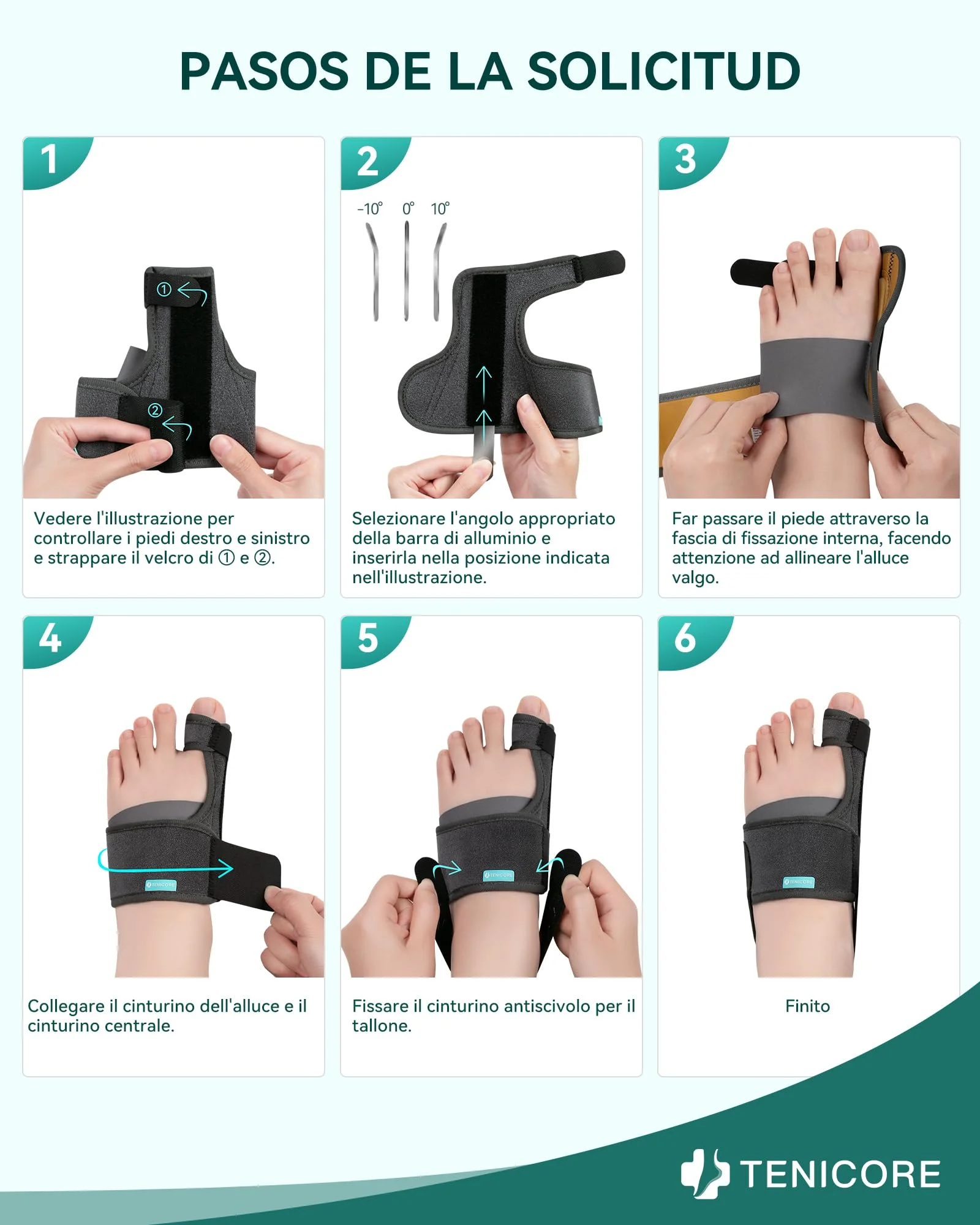 Aggiornamento Alluce Valgo Correttore con 2 Barre Angolari,Tutore Alluce Valgo con cuscinetto in silicone Sollievo dall'alluce Valgo Donna e Uomo 1Paio